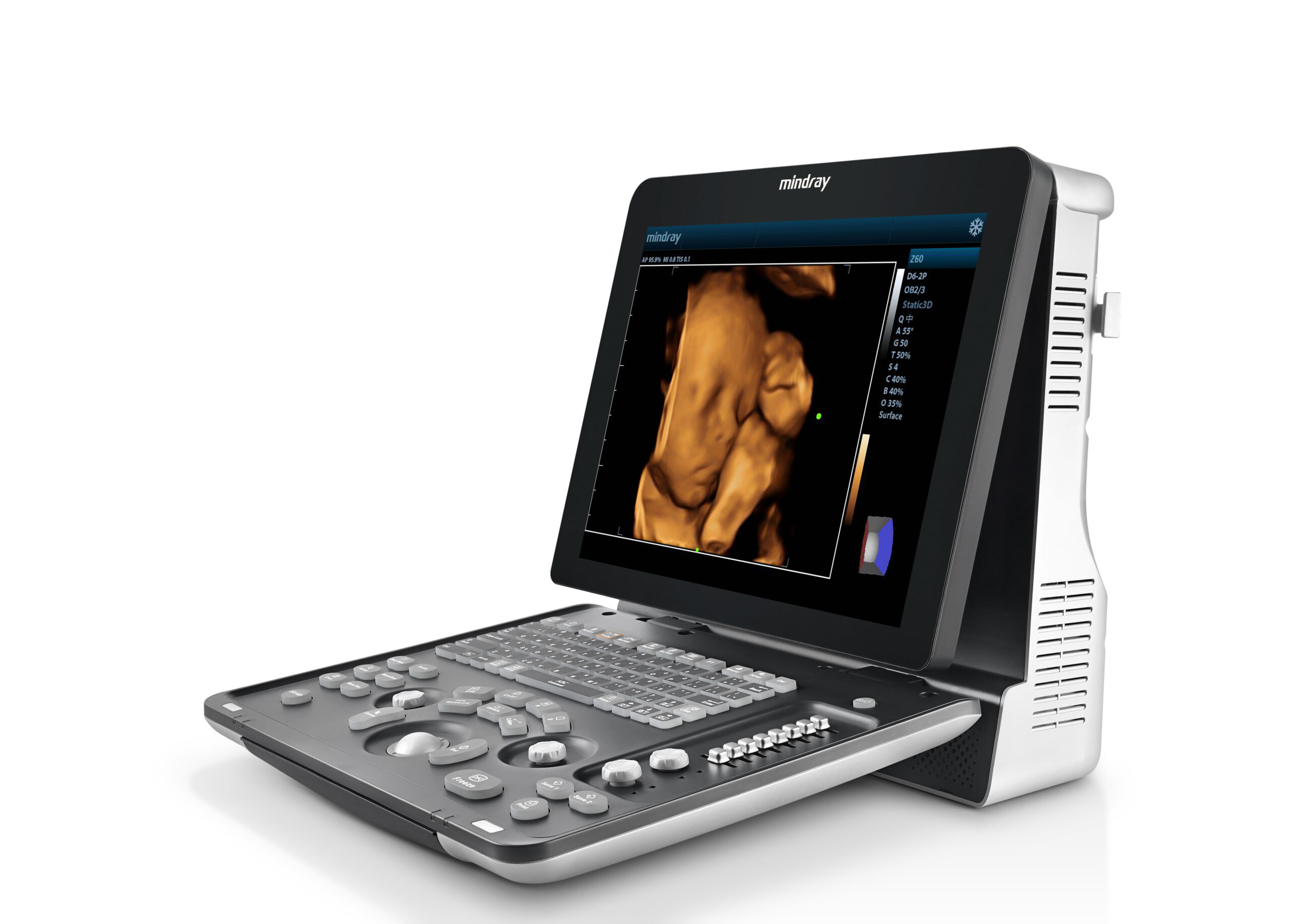 ТОП причин інвестувати в якісні портативні УЗД апарати